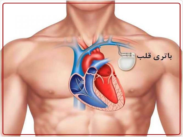 باتری-قلب