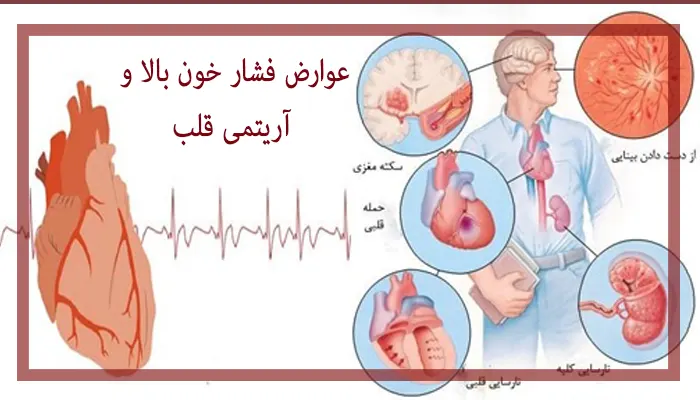 عوارض فشار خون بالا