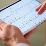 آریتمی سینوسی - دکتر علیرضا قربانی شریف