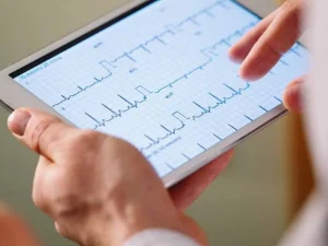 آریتمی سینوسی - دکتر علیرضا قربانی شریف