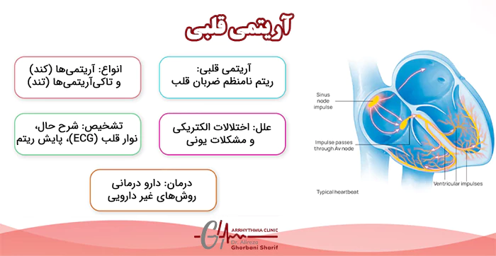 آریتمی قلبی