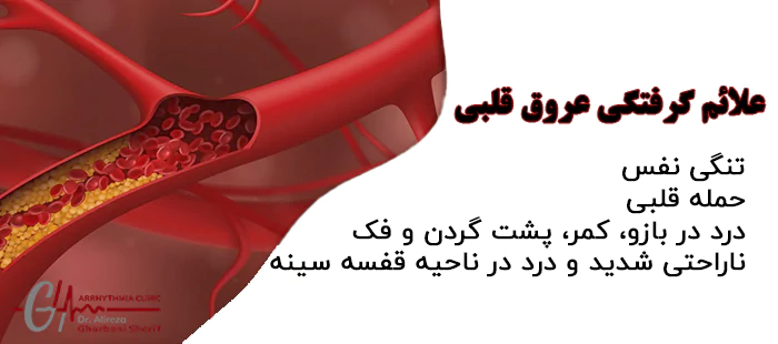 علائم گرفتگی عروق قلبی