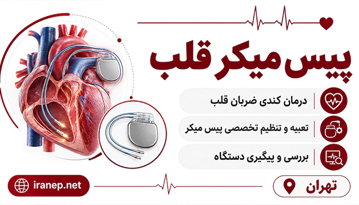 پیس میکر قلب برای درمان کندی ضربان قلب و تنظیم ریتم قلب در تهران